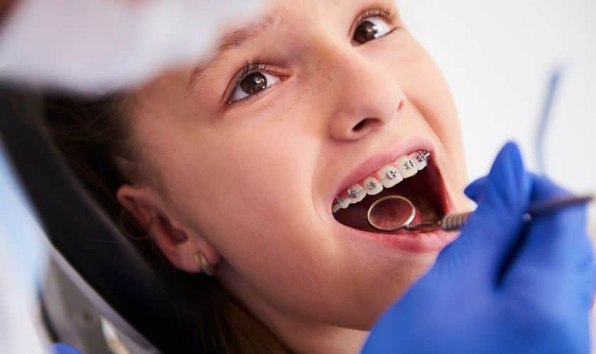Enhancing Smiles: The Magic Of Braces And Orthodontics!